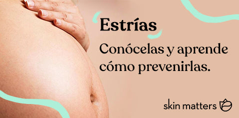 Estrías: Conócelas y aprende cómo prevenirlas